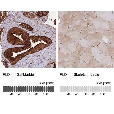 Immunohistochemistry-Paraffin: PLD1 Antibody [NBP2-34078]