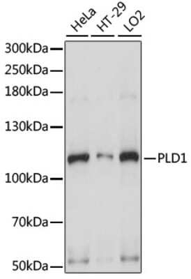 Western Blot: PLD1 AntibodyAzide and BSA Free [NBP2-95164]