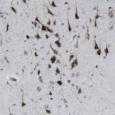 Immunohistochemistry-Paraffin: PLD3/Phospholipase D3 Antibody [NBP1-83146]