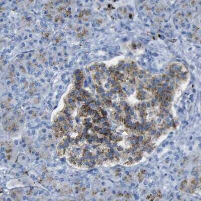 Immunohistochemistry-Paraffin: PLD3/Phospholipase D3 Antibody [NBP1-83146]