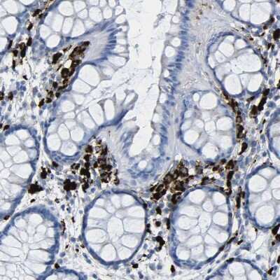 Immunohistochemistry-Paraffin: PLD3/Phospholipase D3 Antibody [NBP1-83146]