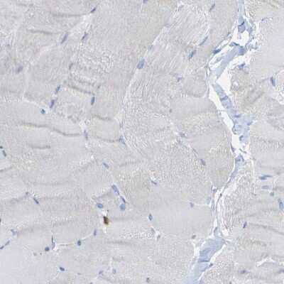 Immunohistochemistry-Paraffin: PLD3/Phospholipase D3 Antibody [NBP1-83146]