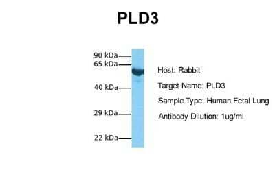 Western Blot: PLD3/Phospholipase D3 Antibody [NBP1-59921]