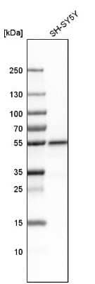 Western Blot: PLD3/Phospholipase D3 Antibody [NBP1-83146]