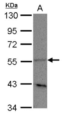 Western Blot: PLD3/Phospholipase D3 Antibody [NBP2-19864]