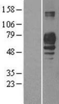 Western Blot: PLD3/Phospholipase D3 Overexpression Lysate [NBL1-14495]