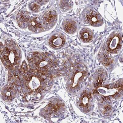 Immunohistochemistry-Paraffin: PLD4/Phospholipase D4 Antibody [NBP2-13770]