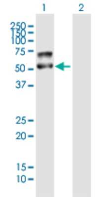 Western Blot: PLD4/Phospholipase D4 Antibody [H00122618-B01P]