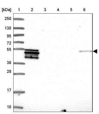 Western Blot: PLD4/Phospholipase D4 Antibody [NBP2-13770]