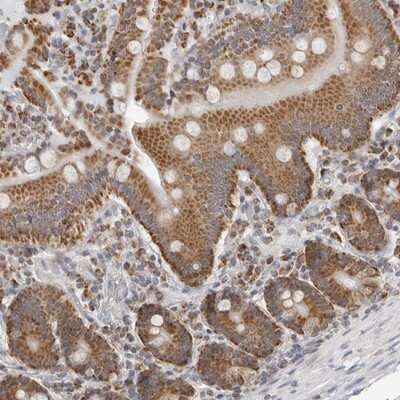 Immunohistochemistry-Paraffin: PLD5 Antibody [NBP1-81911]