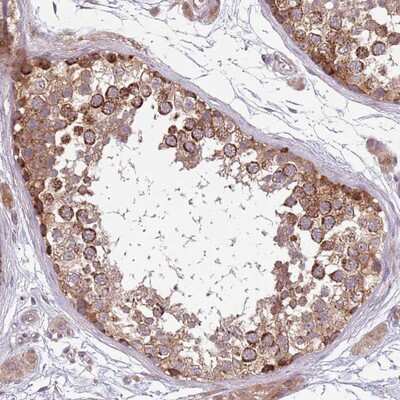 Immunohistochemistry-Paraffin: PLD6 Antibody [NBP2-13771]