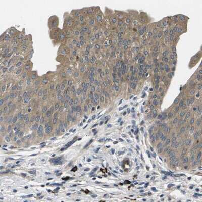 Immunohistochemistry-Paraffin: PLEC1 Antibody [NBP1-92275]