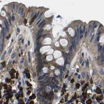 Immunohistochemistry-Paraffin: PLEC1 Antibody [NBP1-92275]