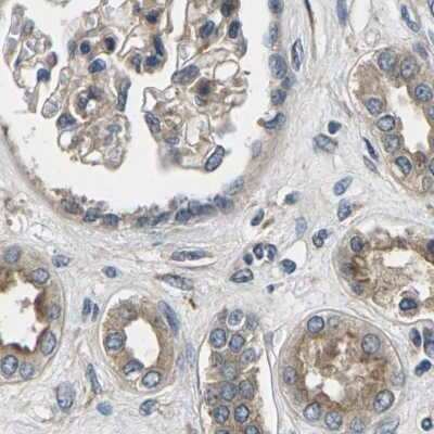 Immunohistochemistry-Paraffin: PLEC1 Antibody [NBP1-92275]