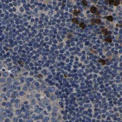 Immunohistochemistry-Paraffin: PLEC1 Antibody [NBP1-92275]