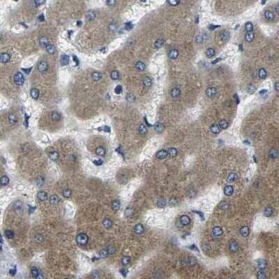 Immunohistochemistry-Paraffin: PLEC1 Antibody [NBP1-92275]