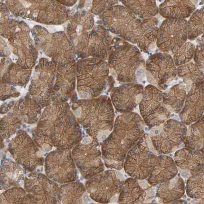 Immunohistochemistry-Paraffin: PLEKHA2 Antibody [NBP1-90655]