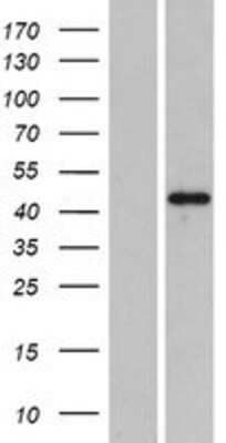 Western Blot: PLEKHA2 Overexpression Lysate [NBP2-06531]