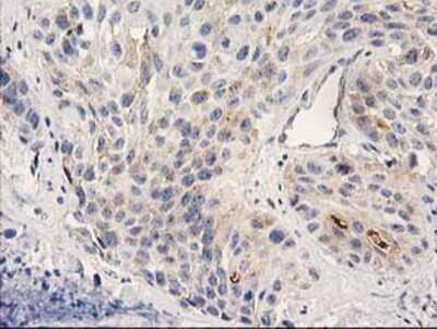 Immunohistochemistry-Paraffin: PLEKHA3 Antibody (OTI5D11) [NBP2-00768]