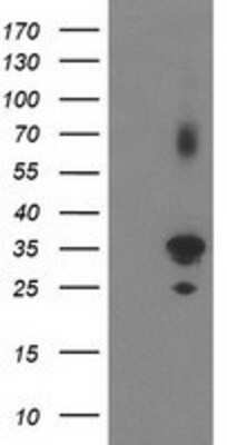 Western Blot: PLEKHA3 Antibody (OTI5D11) [NBP2-00768]