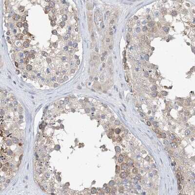 Immunohistochemistry-Paraffin: PLEKHA3 Antibody [NBP2-32018]
