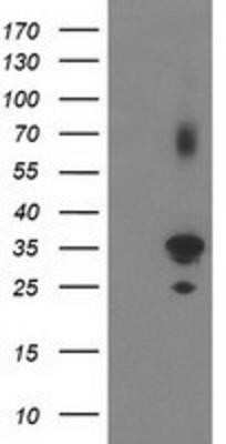 Western Blot: PLEKHA3 Antibody (OTI5D11)Azide and BSA Free [NBP2-73470]