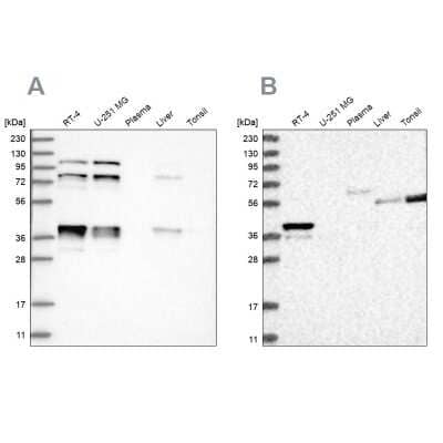 Western Blot: PLEKHA3 Antibody [NBP2-32018]