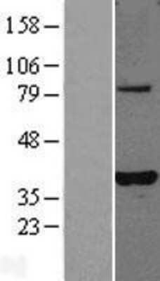 Western Blot: PLEKHA3 Overexpression Lysate [NBL1-14502]