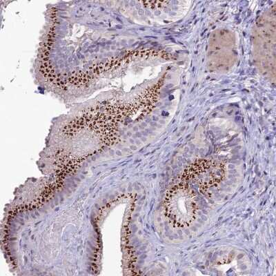 Immunohistochemistry-Paraffin: PLEKHA4 Antibody [NBP2-30945]