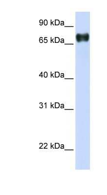 Western Blot: PLEKHA4 Antibody [NBP1-56679]