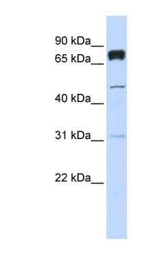 Western Blot: PLEKHA4 Antibody [NBP1-57684]