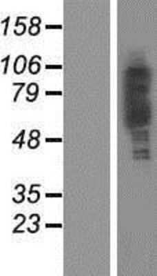 Western Blot: PLEKHA4 Overexpression Lysate [NBP2-06590]