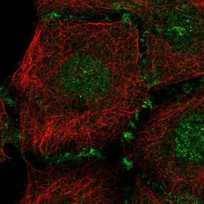 Immunocytochemistry/ Immunofluorescence: PLEKHA7 Antibody [NBP2-68835]