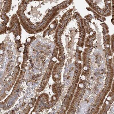 Immunohistochemistry-Paraffin: PLEKHA7 Antibody [NBP1-85045]