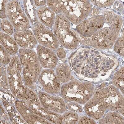 Immunohistochemistry-Paraffin: PLEKHA7 Antibody [NBP1-85045]