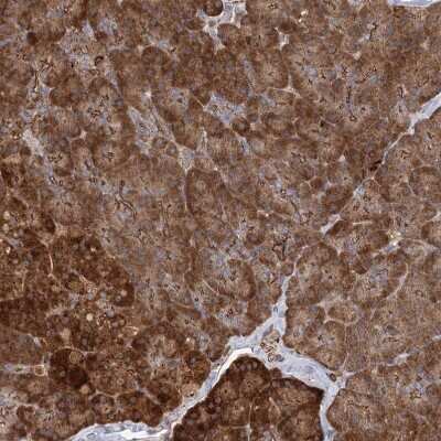 Immunohistochemistry-Paraffin: PLEKHA7 Antibody [NBP1-85045]