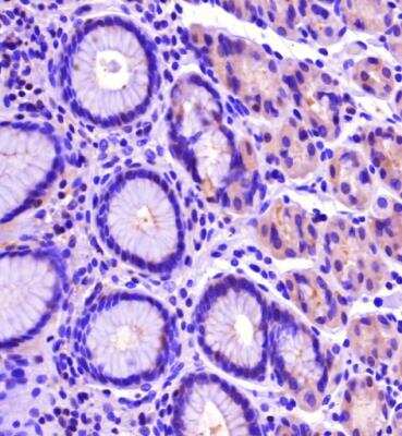 Immunohistochemistry-Paraffin: PLEKHA7 Antibody - BSA Free [NBP2-76328]