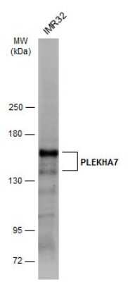 Western Blot: PLEKHA7 Antibody [NBP3-12994]