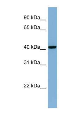 Western Blot: PLEKHA9 Antibody [NBP1-70675]