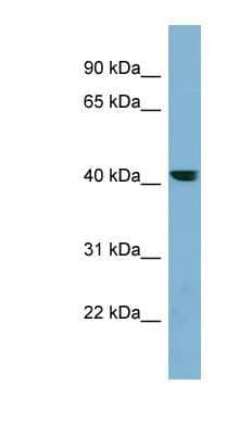 Western Blot: PLEKHA9 Antibody [NBP1-70676]