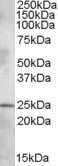 Western Blot: PLEKHB1/PHR1 Antibody [NBP1-28489]