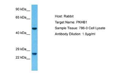 Western Blot: PLEKHB1/PHR1 Antibody [NBP2-84220]