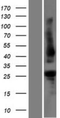 Western Blot: PLEKHB1/PHR1 Overexpression Lysate [NBP2-06551]