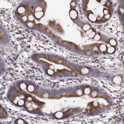 Immunohistochemistry: PLEKHB2 Antibody [NBP2-68994]
