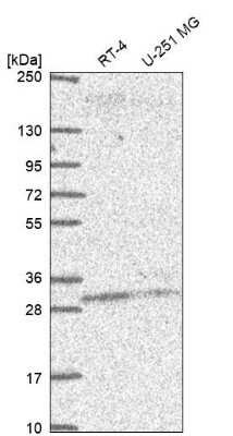 Western Blot: PLEKHB2 Antibody [NBP2-68994]