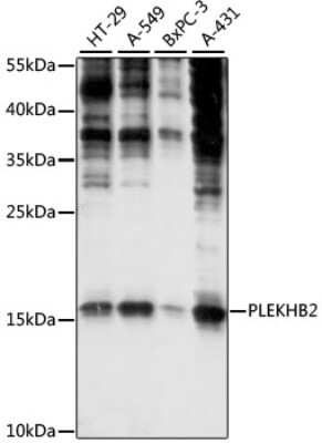 Western Blot: PLEKHB2 AntibodyAzide and BSA Free [NBP2-94817]