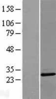 Western Blot: PLEKHB2 Overexpression Lysate [NBL1-14506]