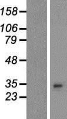 Western Blot: PLEKHB2 Overexpression Lysate [NBP2-09177]