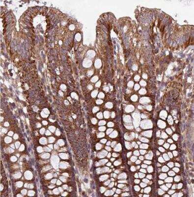 Immunohistochemistry-Paraffin: PLEKHD1 Antibody [NBP2-14750]