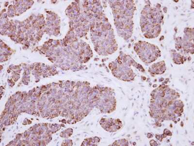 Immunohistochemistry-Paraffin: PLEKHF2 Antibody [NBP2-19865]